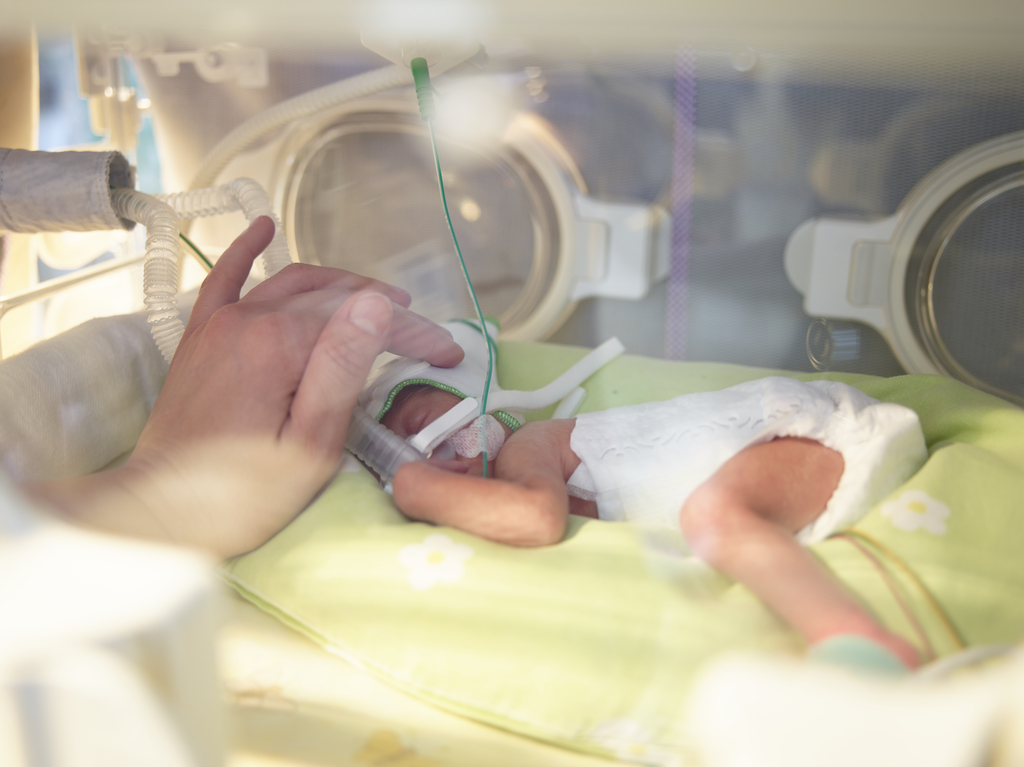 Beatmung beim Atemnotsyndrom (IRDS)